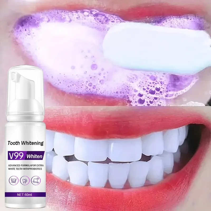 Teeth Whitening Mousse - Mousse V99 Tandpasta Tandenreiniging Effectieve Whitening