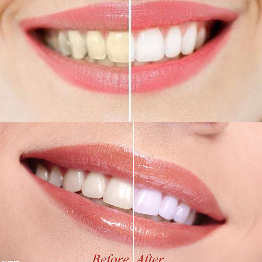 Bamboe Houtskool Tanden Dental - Teeth Whitening Powder recensie en prijs
