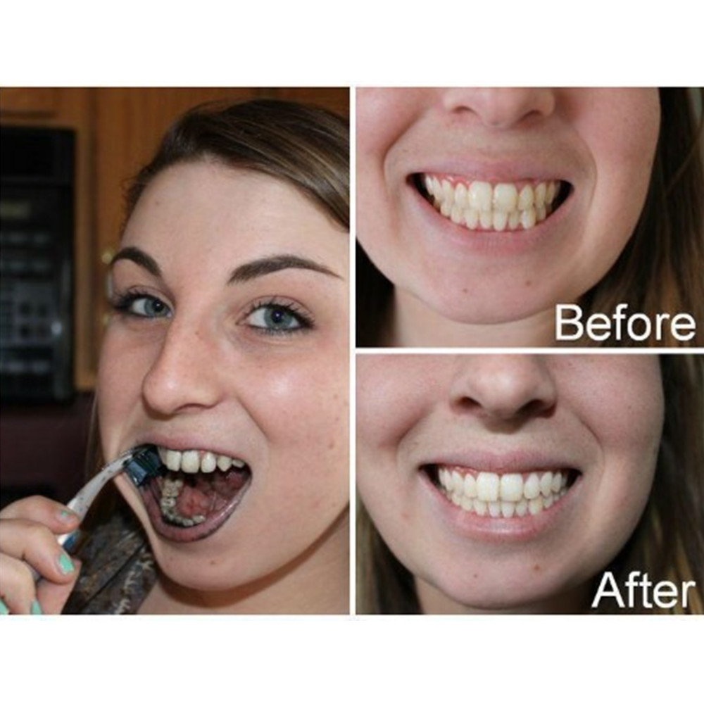 Bamboe Houtskool Tanden Dental - Teeth Whitening Powder recensie en prijs