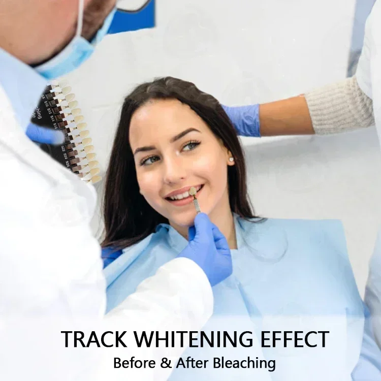 Professionele Tanden Whitening - Teeth Whitening Shade Guide recensie en prijs