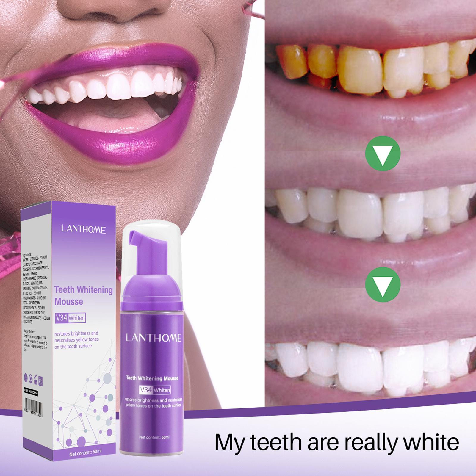 V34 Mousse Tanden Reinigen Tan - Teeth Whitening Mousse recensie en prijs