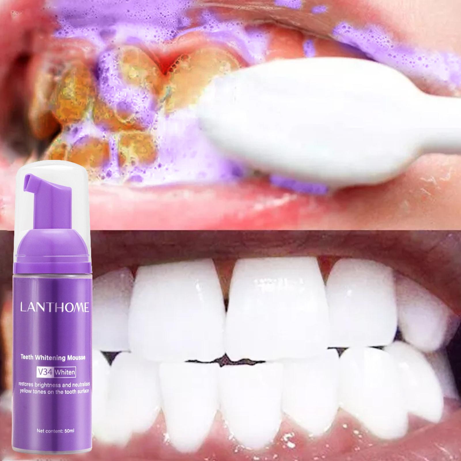 V34 Mousse Tanden Reinigen Tan - Teeth Whitening Mousse recensie en prijs