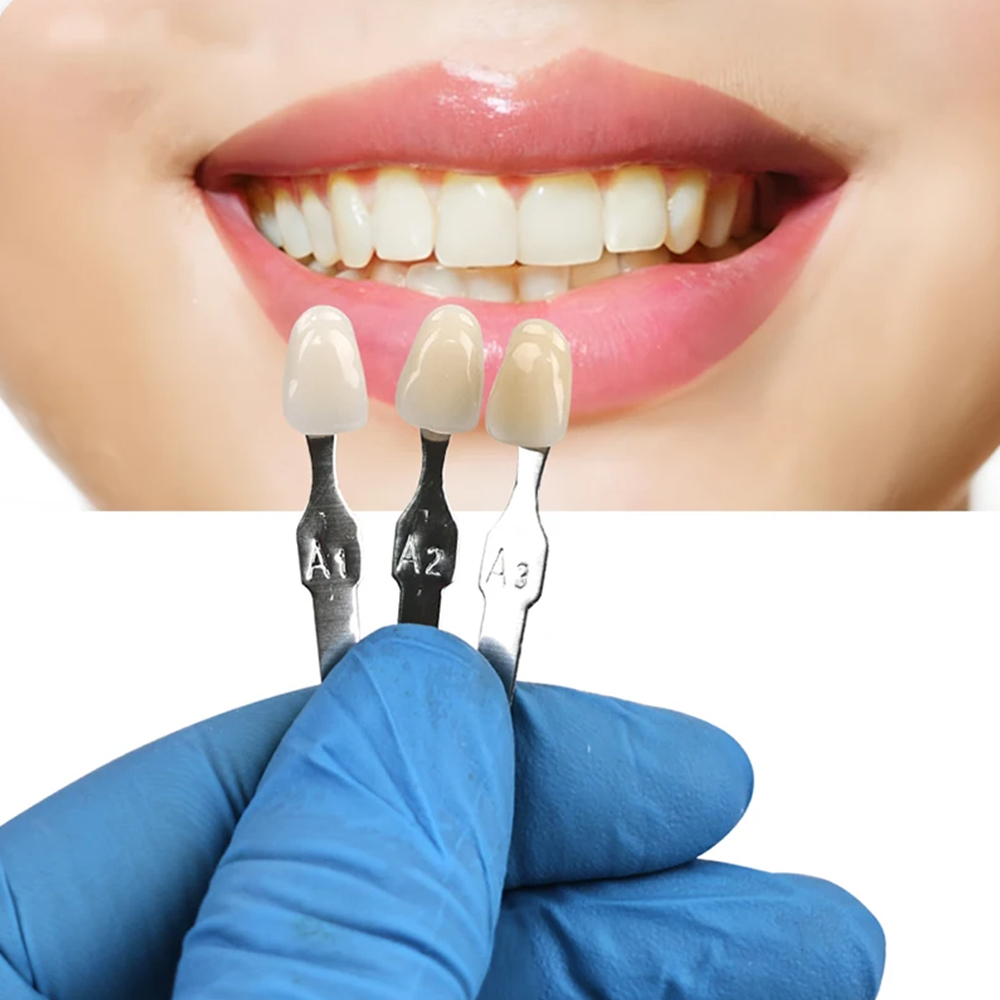 VITA 16 Kleuren Tanden Schaduw - Teeth Whitening Shade Guide recensie en prijs