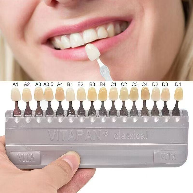 VITA 16 Kleuren Tanden Schaduw - Teeth Whitening Shade Guide recensie en prijs