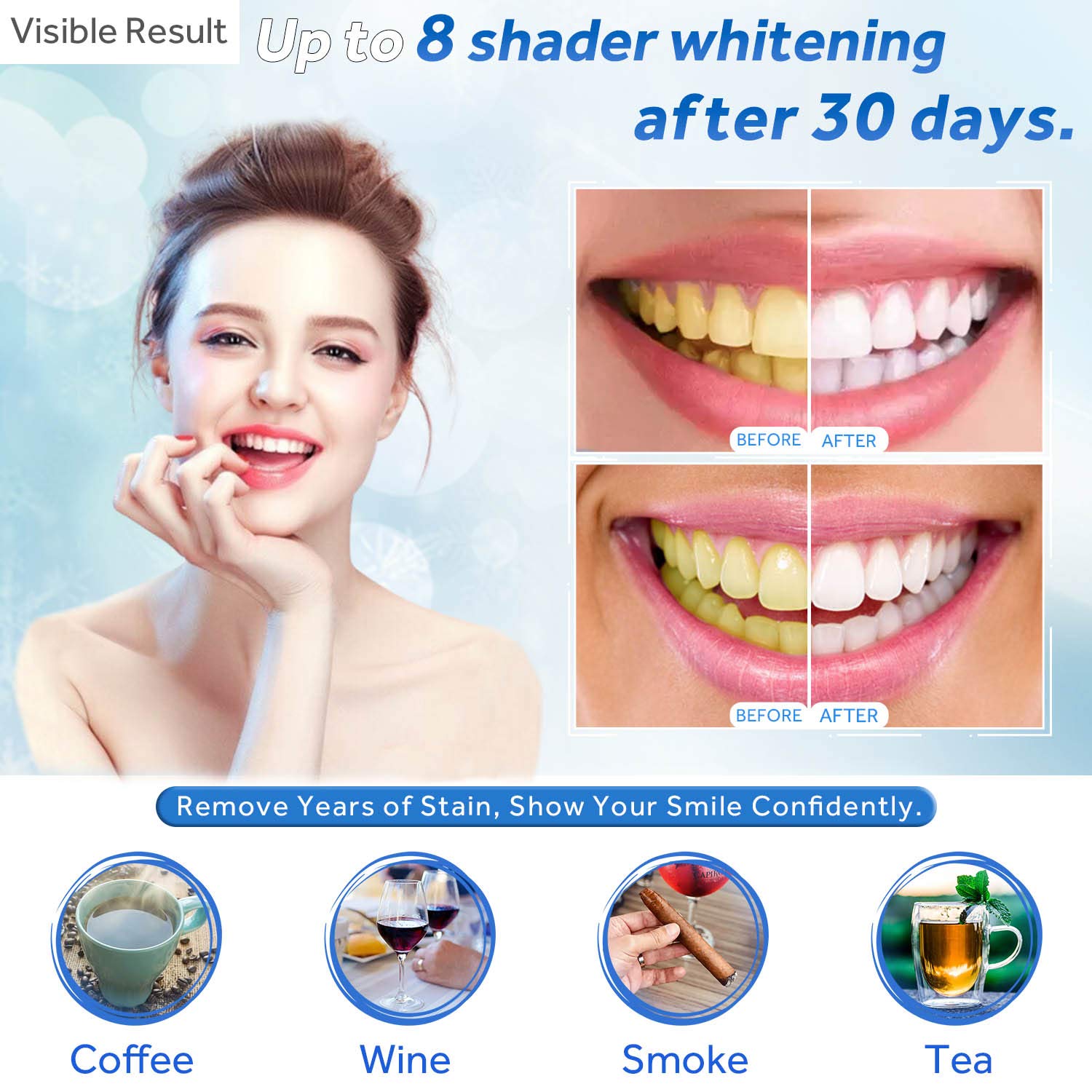 Tanden Whitening Gel Refill Sp - Teeth Whitening Led Kit recensie en prijs