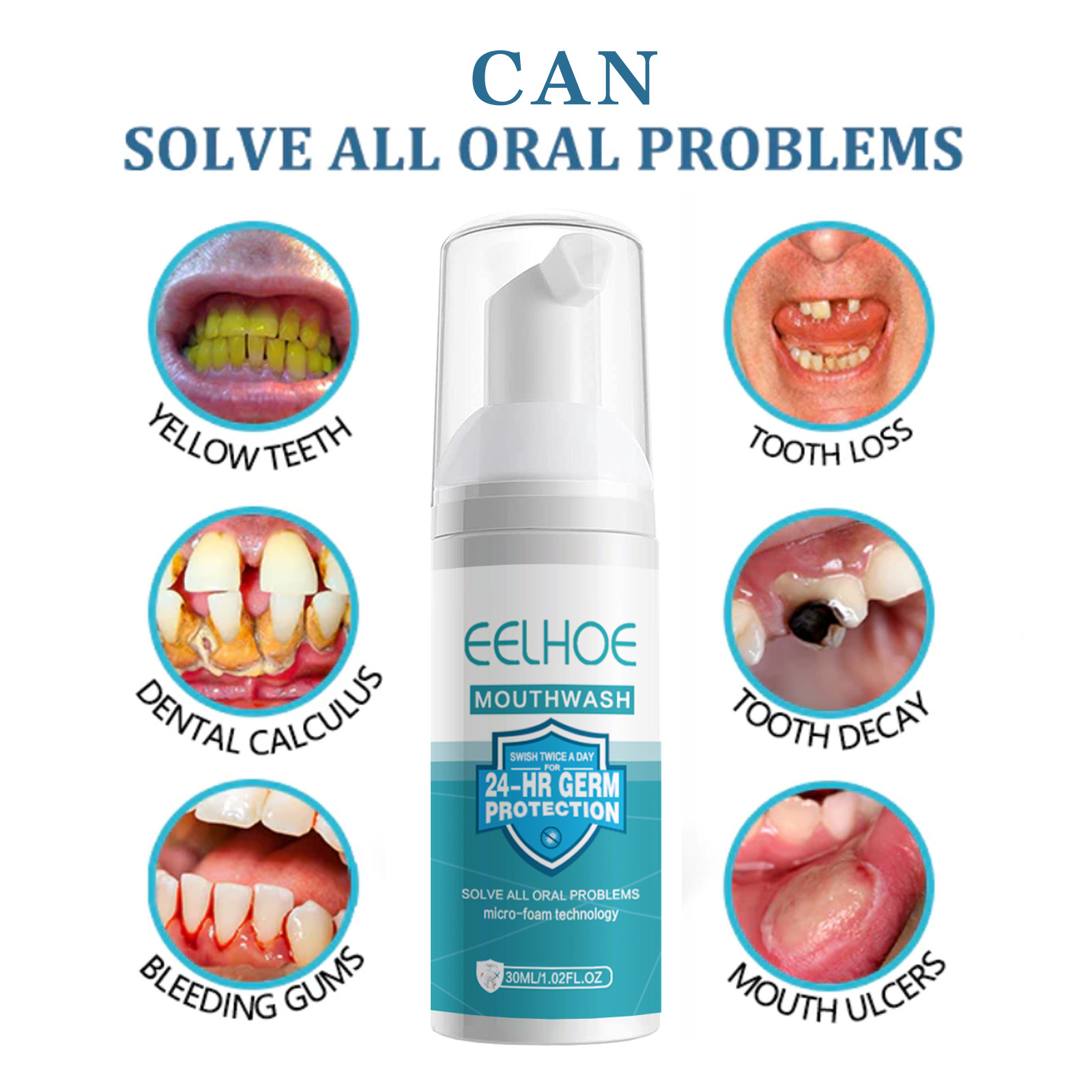 EELHOE Tanden Whitening Reinig - Teeth Whitening Mousse recensie en prijs