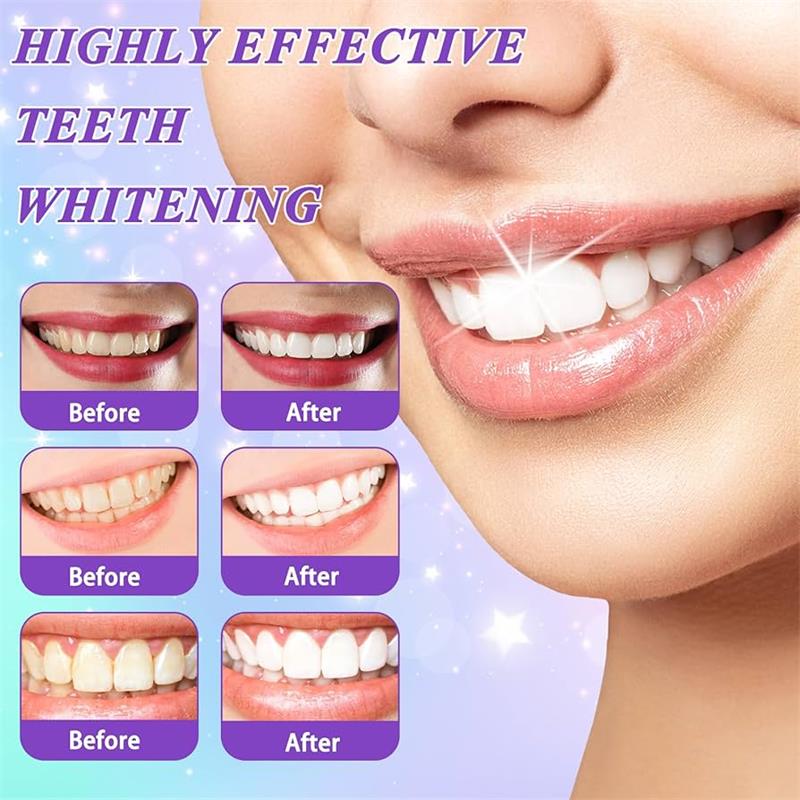 9D Paarse Tandenbleek Tandpast - Teeth Whitening Mousse recensie en prijs