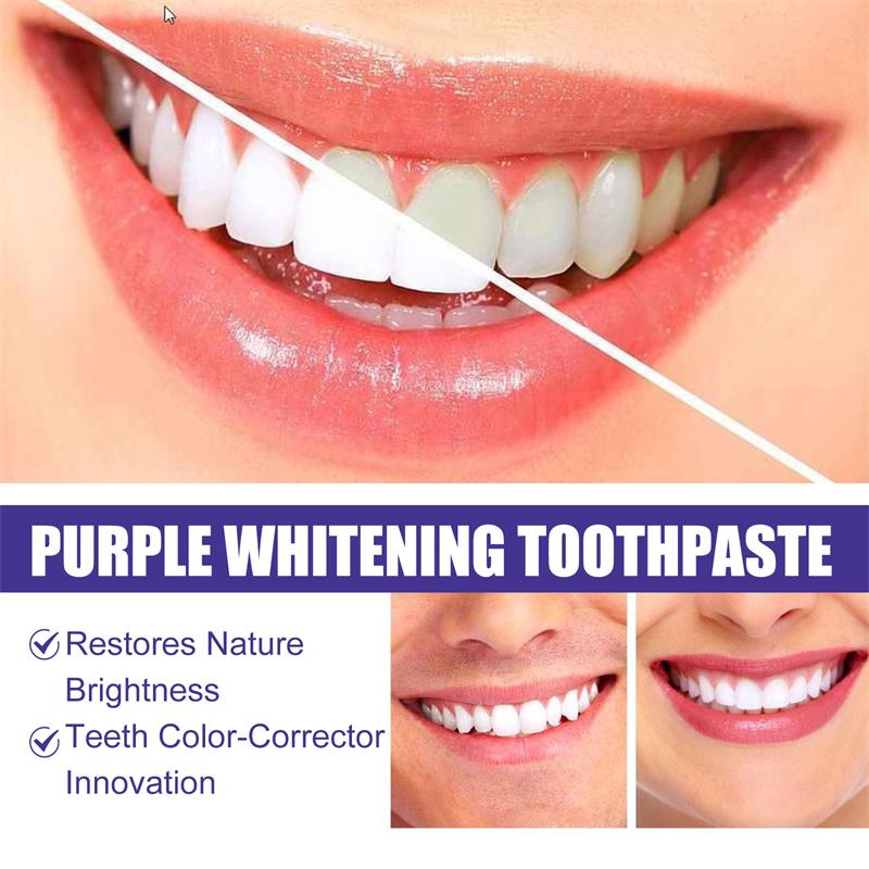 9D Paarse Tandenbleek Tandpast - Teeth Whitening Mousse recensie en prijs
