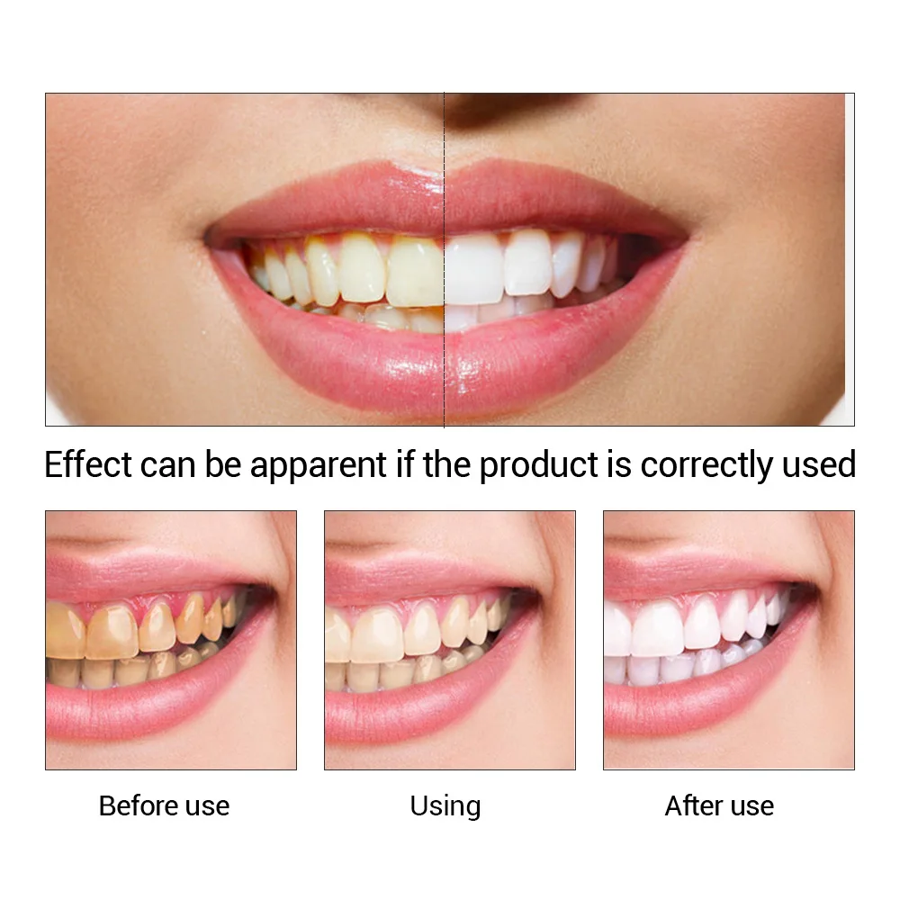 Fteenply Tanden Whitening Esse - Teeth Whitening Powder recensie en prijs