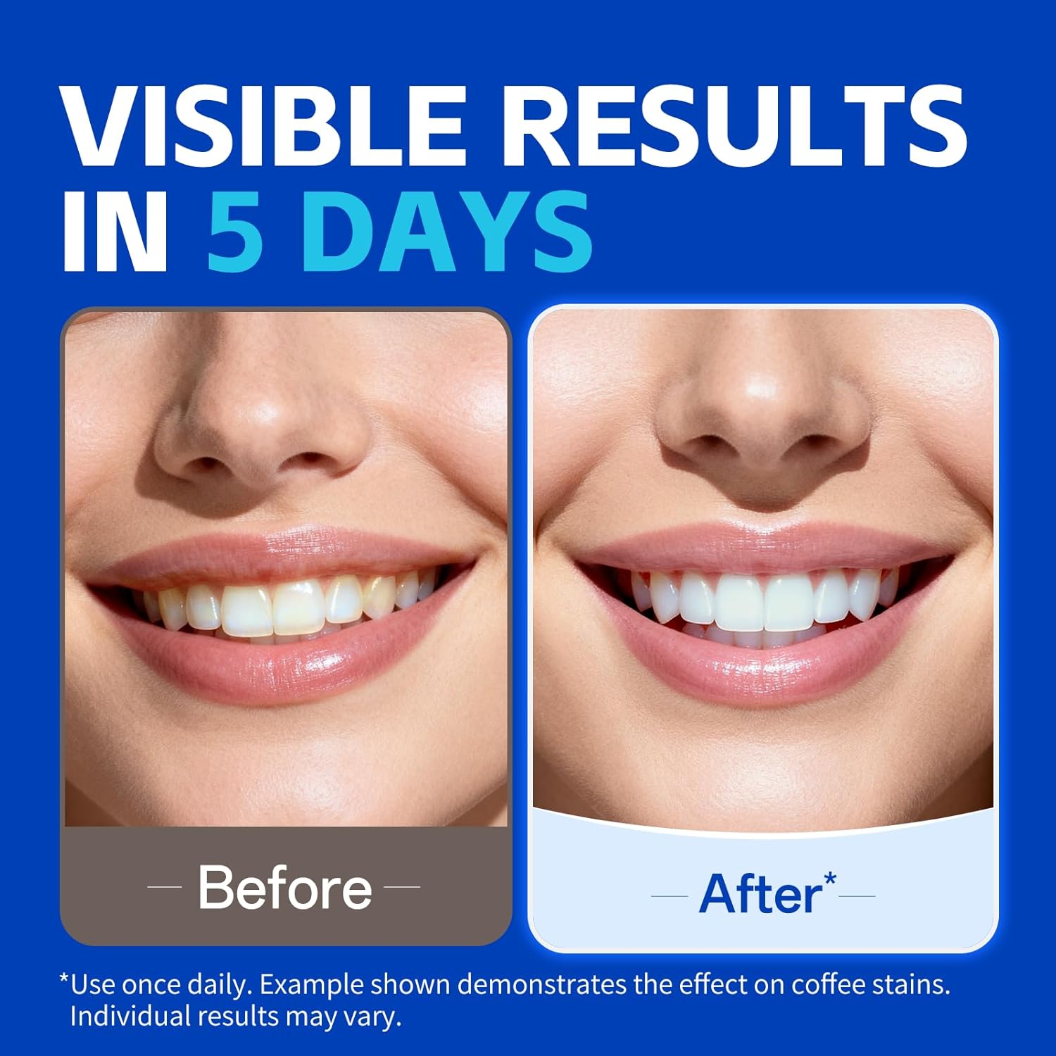 7 paar tandenbleekstrips voor  - Teeth Whitening Strips Crest recensie en prijs