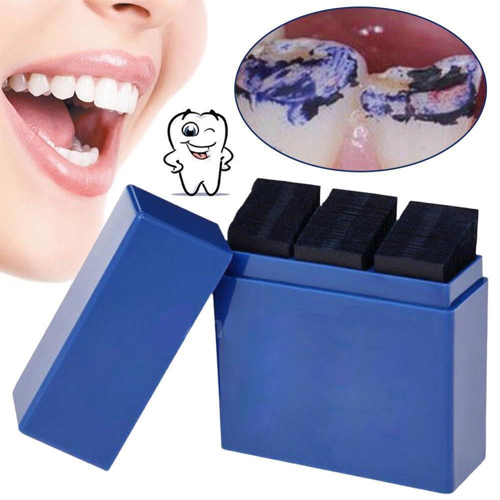 300 Vellen Tandheelkundige Art - Teeth Whitening Retainer recensie en prijs