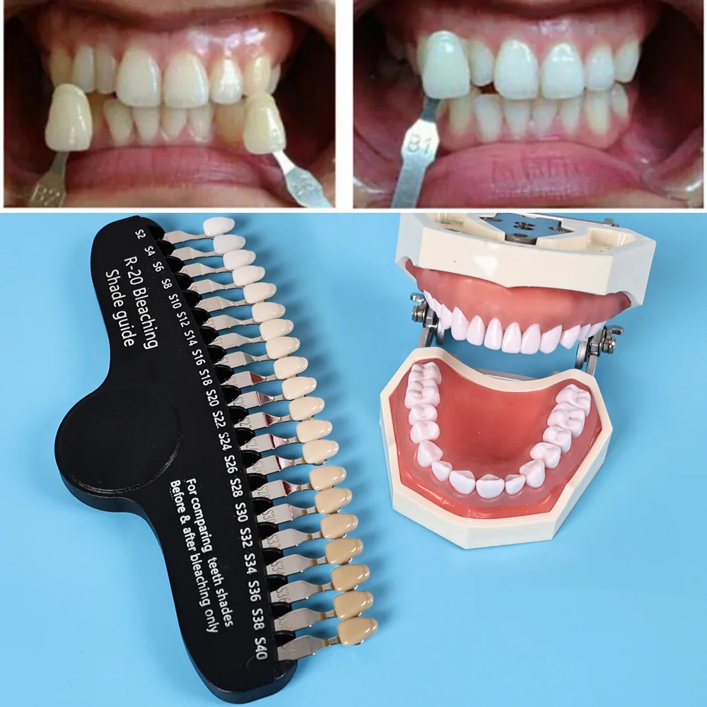 ELIJAH R-20 Bleken Schaduw Gid - Teeth Whitening Shade Guide recensie en prijs
