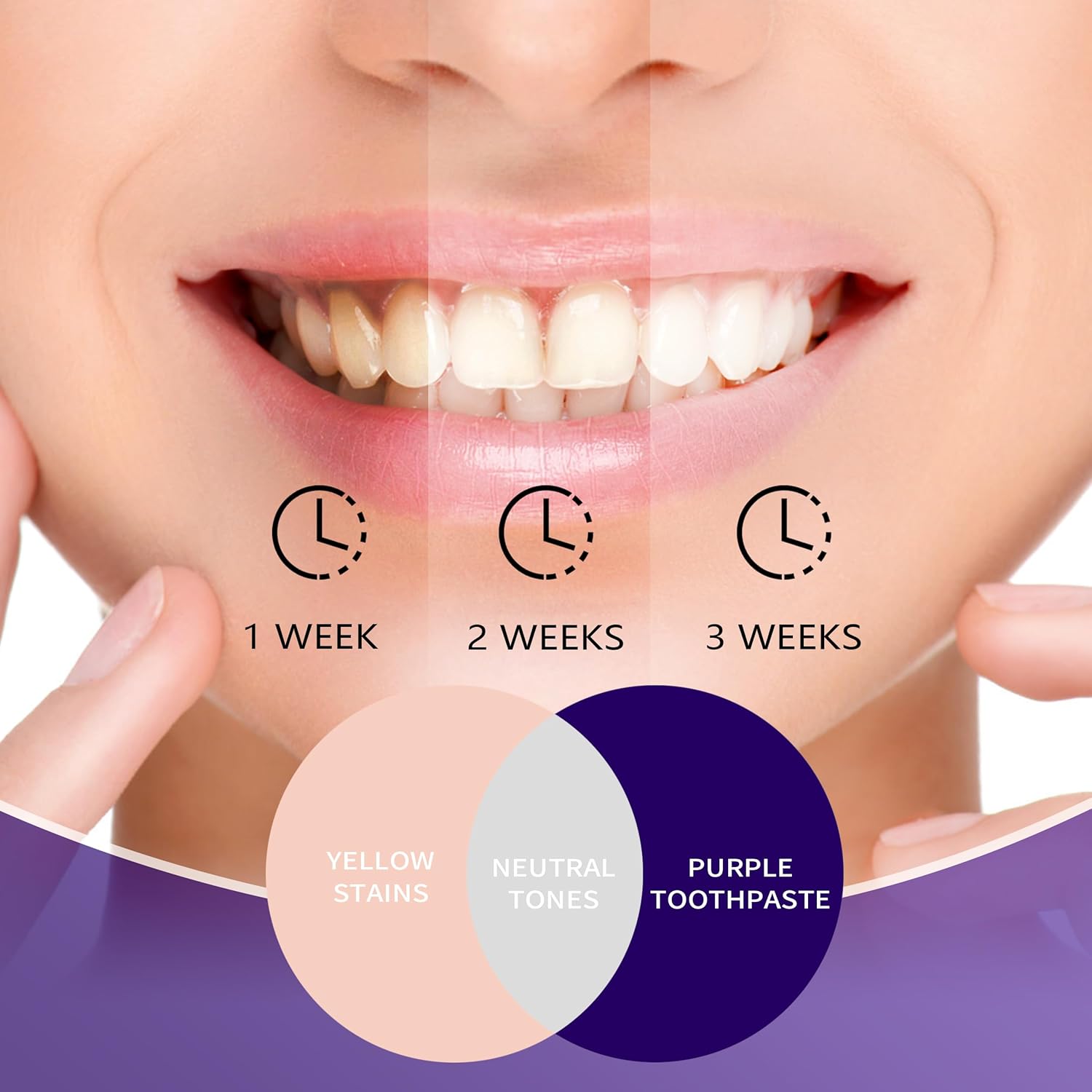Paarse tandpasta voor het blek - Teeth Whitening Mousse recensie en prijs
