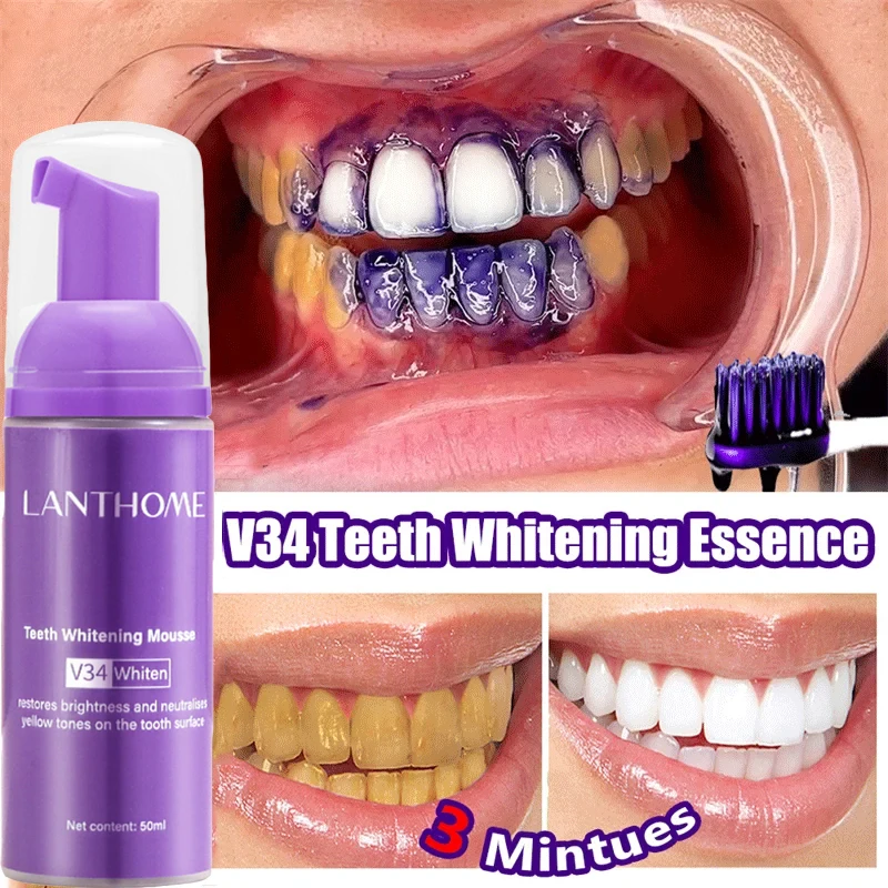 V34 Tanden Whitening Mousse Ta - Teeth Whitening Mousse recensie en prijs