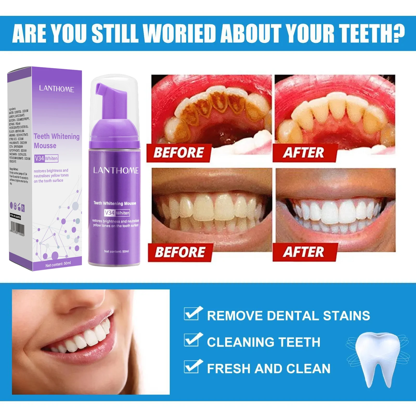 V34 Tanden Whitening Mousse Ta - Teeth Whitening Mousse recensie en prijs