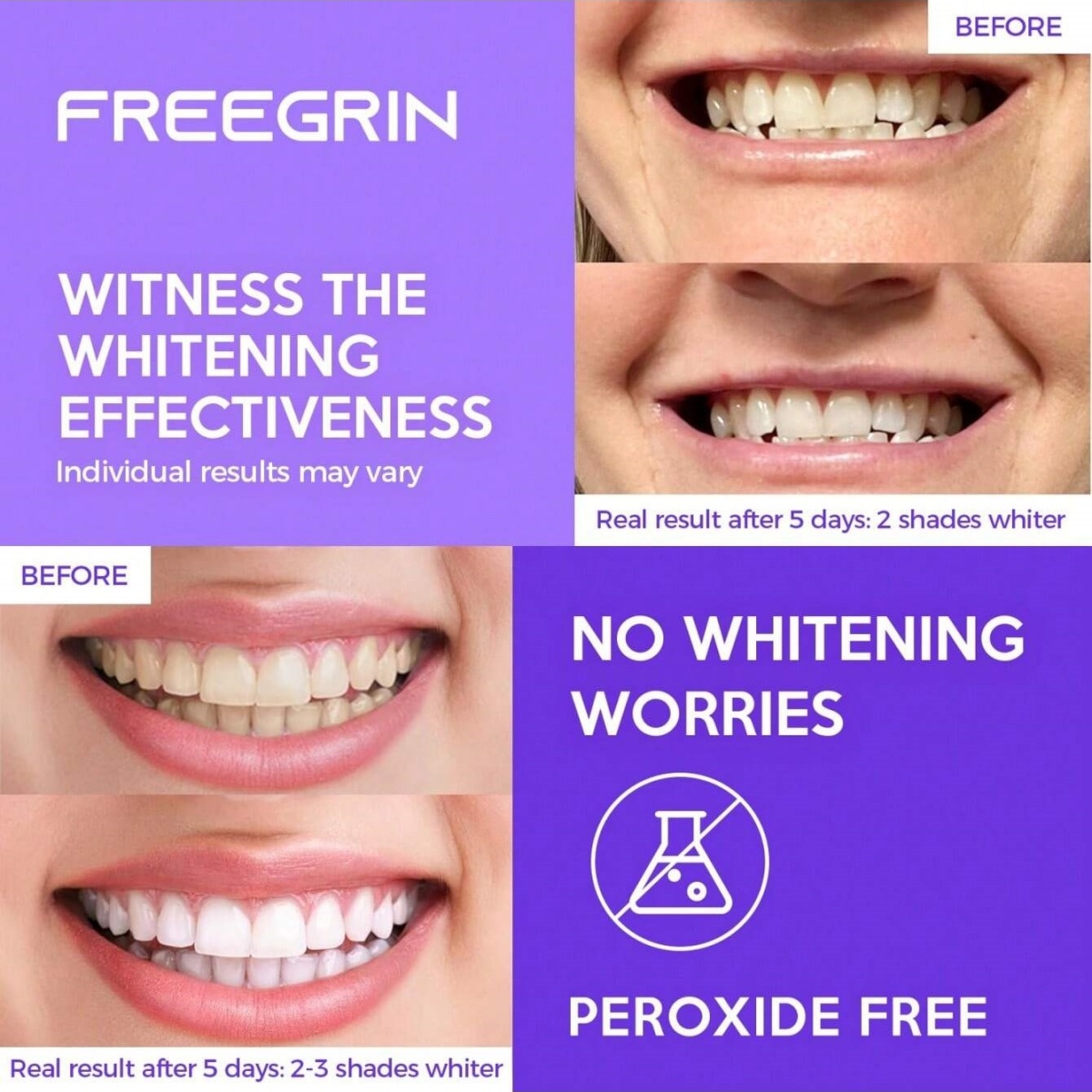 Deluxe Tanden Whitening Sticke - Teeth Whitening With Peroxide recensie en prijs