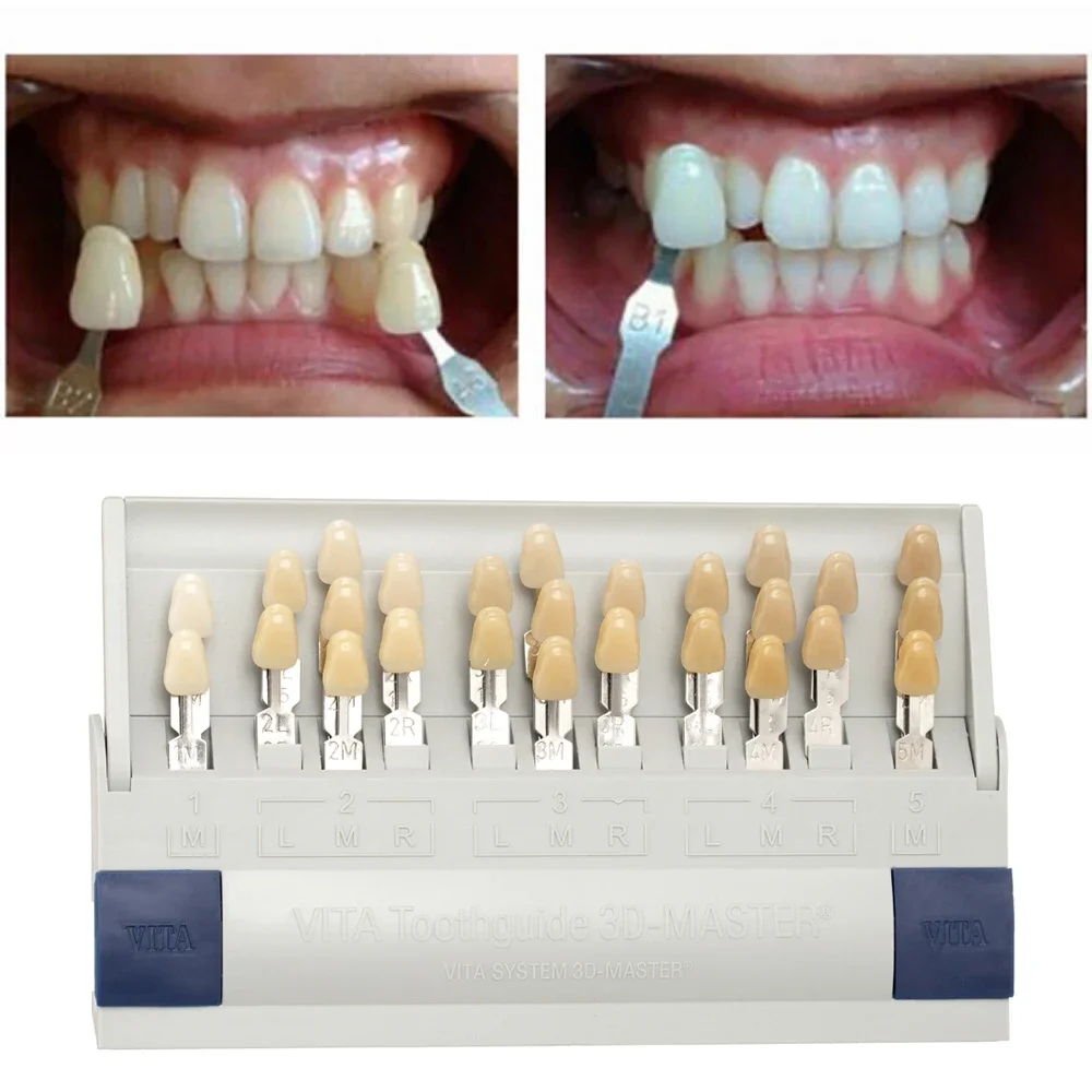Vita 3D Master Dental Lab Blea - Teeth Whitening Shade Guide recensie en prijs
