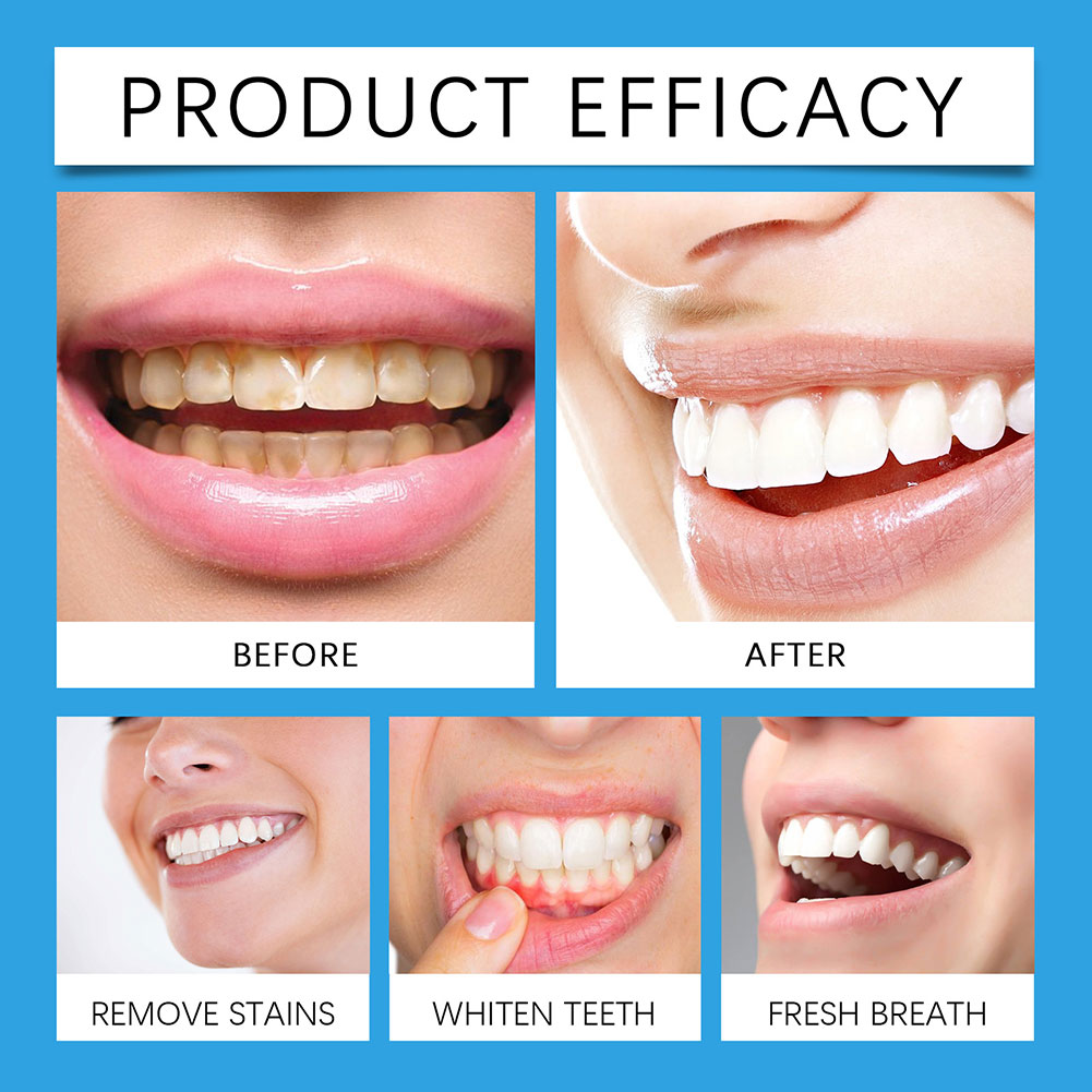 Professioneel tandvlekverwijde - Teeth Whitening For Photos recensie en prijs